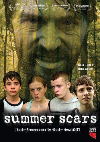 Summer Scars is similar to The Painter and the Model.